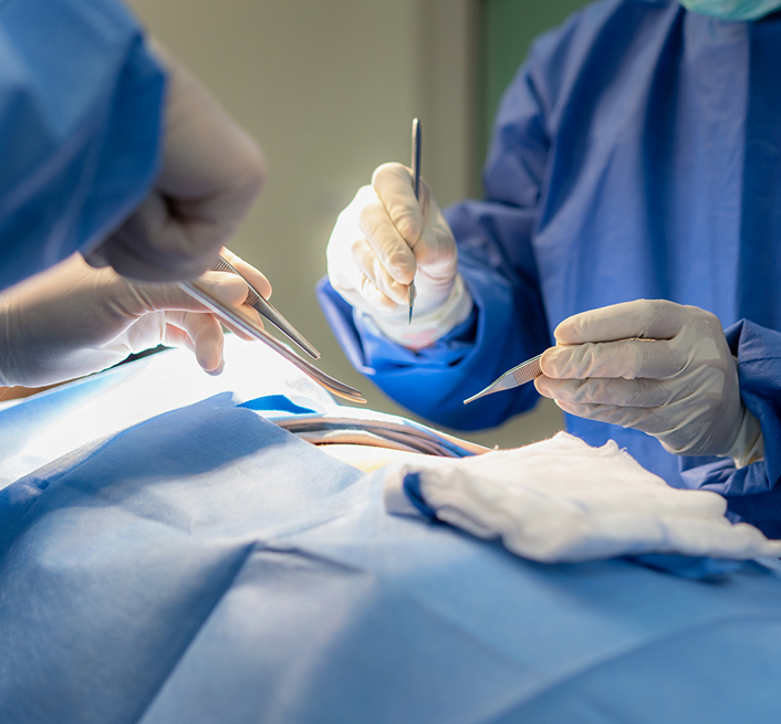 Sleeve Gastrectomy Surgery