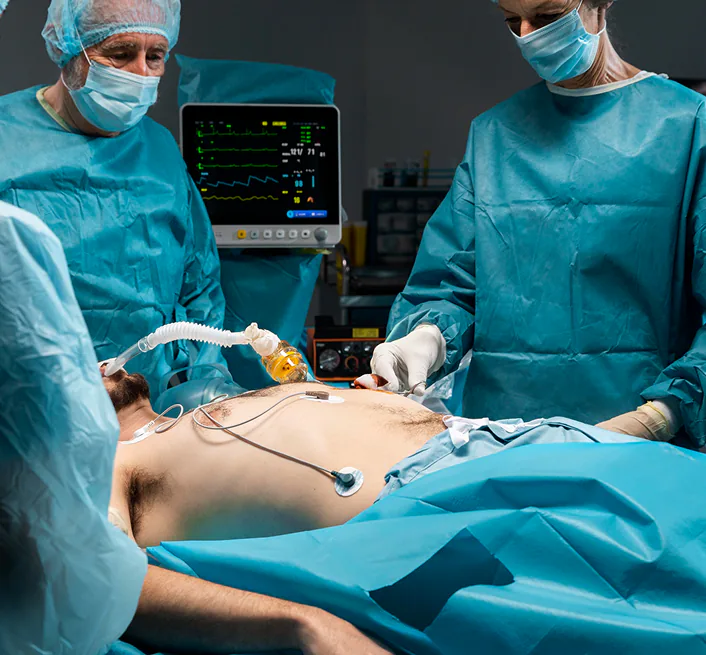 Sleeve Gastrectomy Surgery